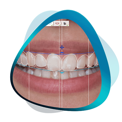 Learn Digital Smile Design Institute Of Digital Dentistry