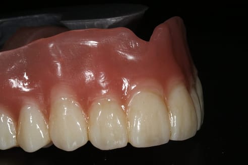 Graphy Tera Herz Flexible Base - Printed Partial Denture Review