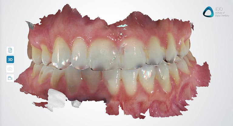 Fussen DentaLink Scanner Review | Institute of Digital Dentistry