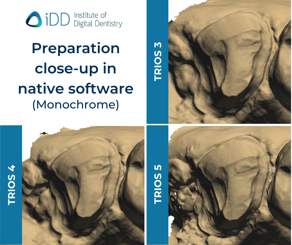 iDD-compares-monochrome-zoom-scans-3shape-intraoral-scanner-trios3-trios4-trios5