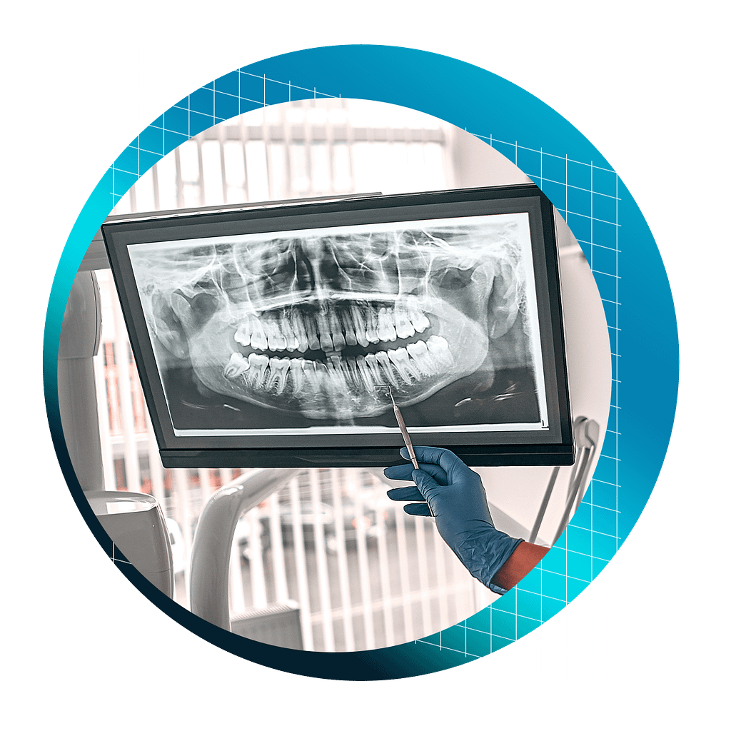 2D Dental Radiography Interpretation Course - Institute of Digital ...