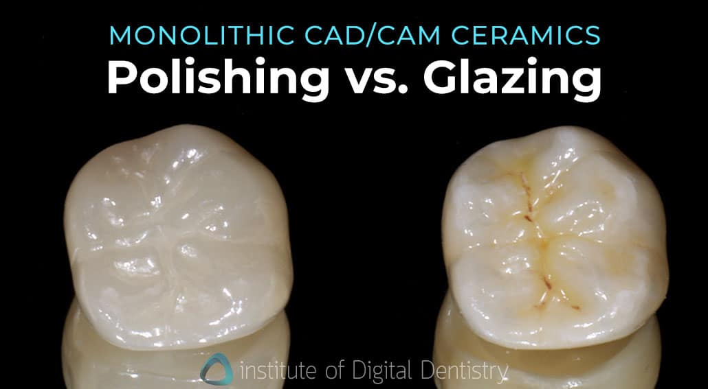 Polishing VS Glazing Dental Ceramics Digital Dentistry Blog iDD