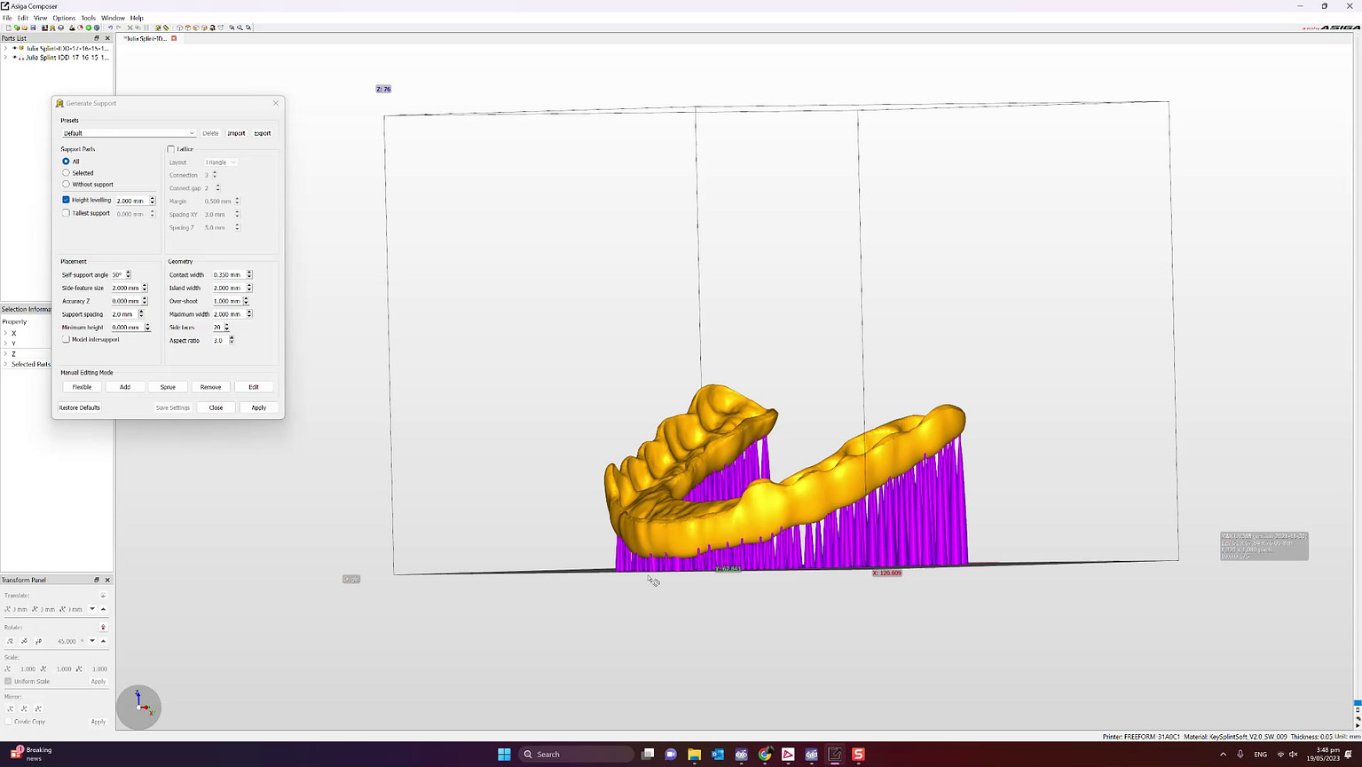 How to 3D Print Splints and Nightguards using Keysplint Soft