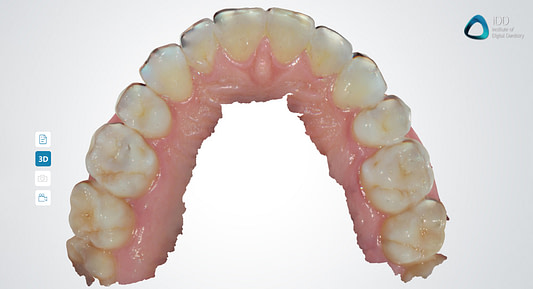 full arch scans dentaLink IOS fussen institute of digital dentistry (3)