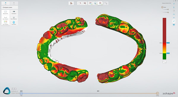 3shape Log 3Shape Unite Review | Institute of Digital Dentistry