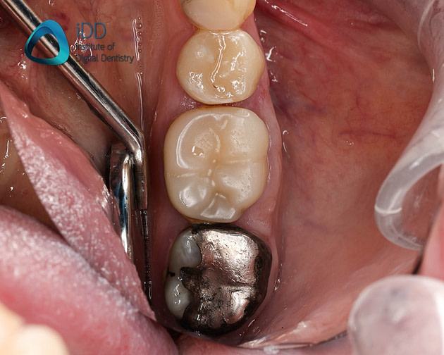 Preoperative image of a patient 