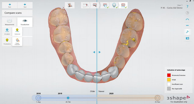 TRIOS Patient Monitoring