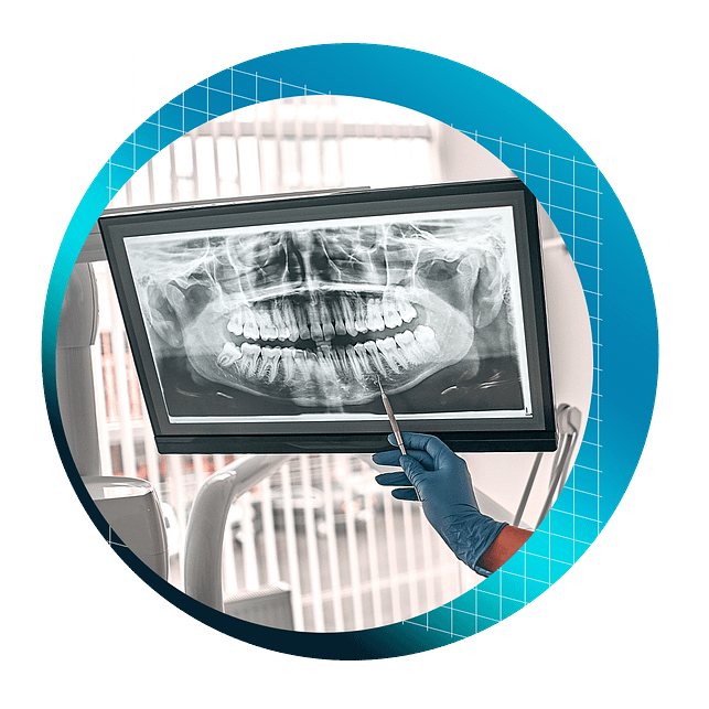 2D Dental Radiography Interpretation Course Institute of Digital