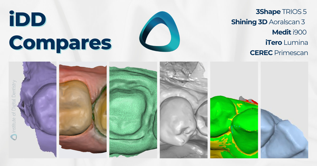 iDD Compares iTero Lumina and Medit i900 vs. Other IOS