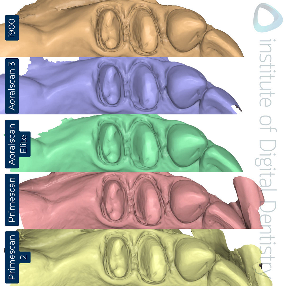 dentsply-sirona-primescan-2-cerec-primescan-shining-3d-dental-aoralscan-3-elite-medit-i900-intraoral-scanner-comparison-idd-compares-institute-of-digital-dentistry-blog-stl-scan-view