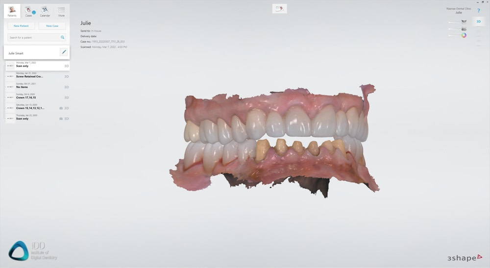 3Shape Unite Review | Institute of Digital Dentistry