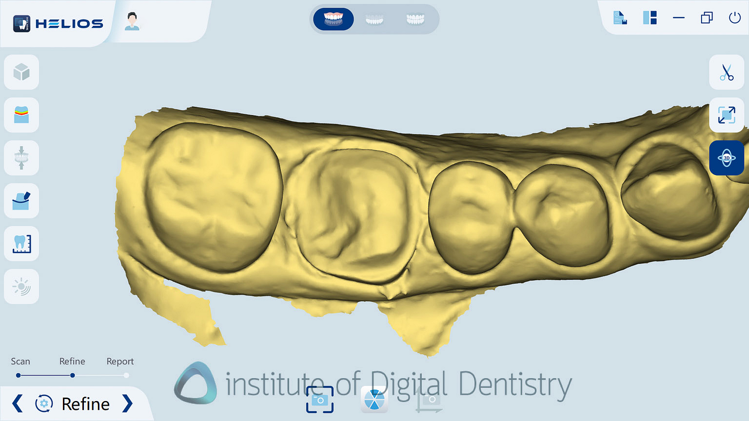 helios_500_review_intra_oral_scanner_iDD17