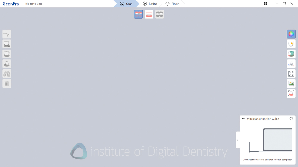 alliedstar_sensa_intraoral_scanner_review_iDD (13)