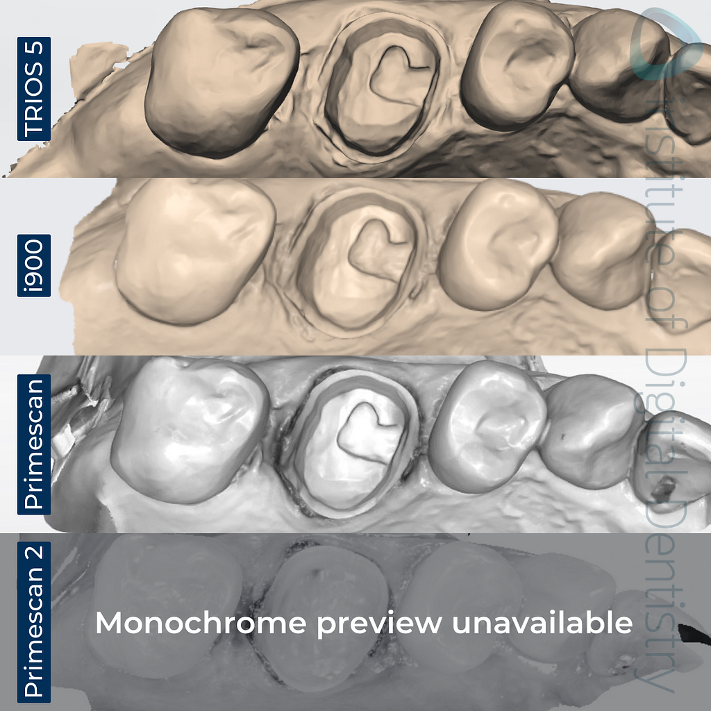 dentsply-sirona-primescan-2-3shape-trios-5-medit-i900-cerec-primescan-intraoral-scanner-comparison-idd-compares-institute-of-digital-dentistry-blog-native-monochrome-scans