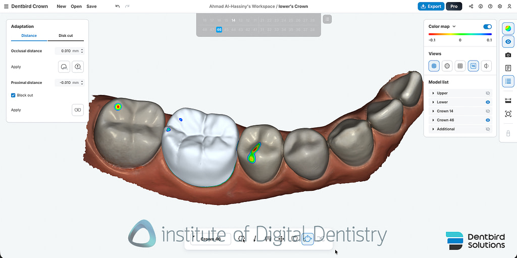 CAD Software in Dentistry - How Everything is Going to the Cloud