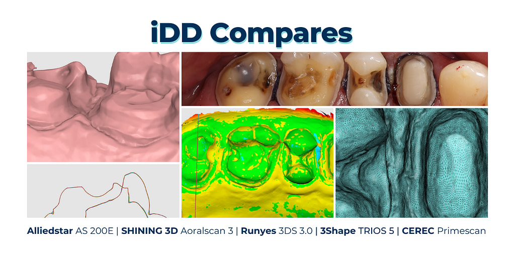 iDD Compares: Affordable vs Expensive Intraoral Scanners - Institute of ...