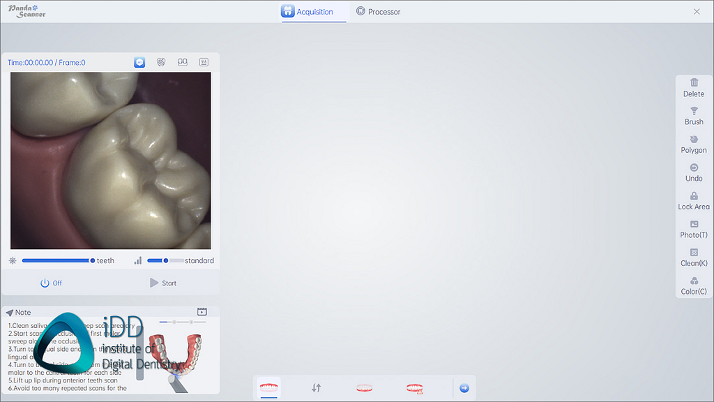 panda_smart_IOS_review_intraoral_scanner_institute_of_digital_dentistry (9)