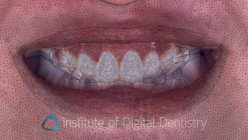 metismile_rayface_qlone_dental_face_scanners (6)