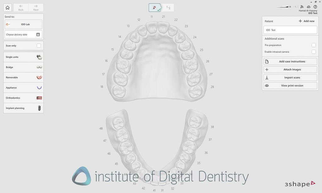 3shape_software_dental_studio_idd_review18