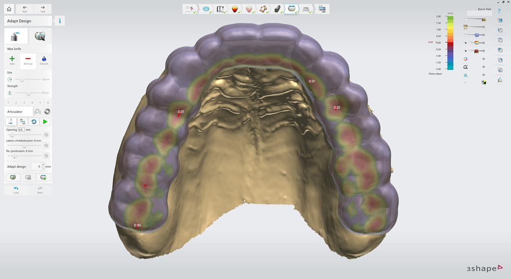 3shape-intraoral-trios-scan-bite-splint-idd-institute-of-digital-dentistry-blog-byron-park-splint-studio-adapt-design