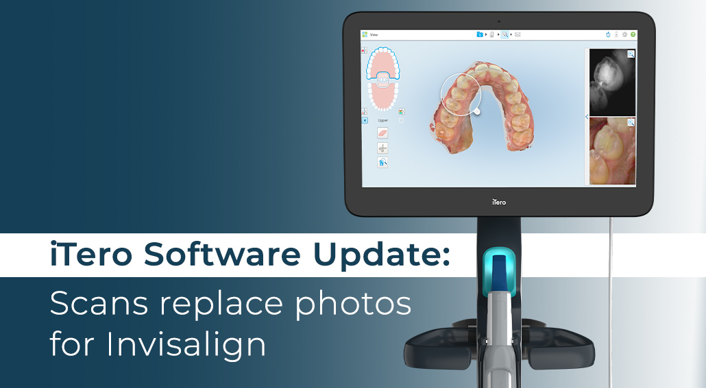 iTero New Software Release Workflow 2.0 iDD