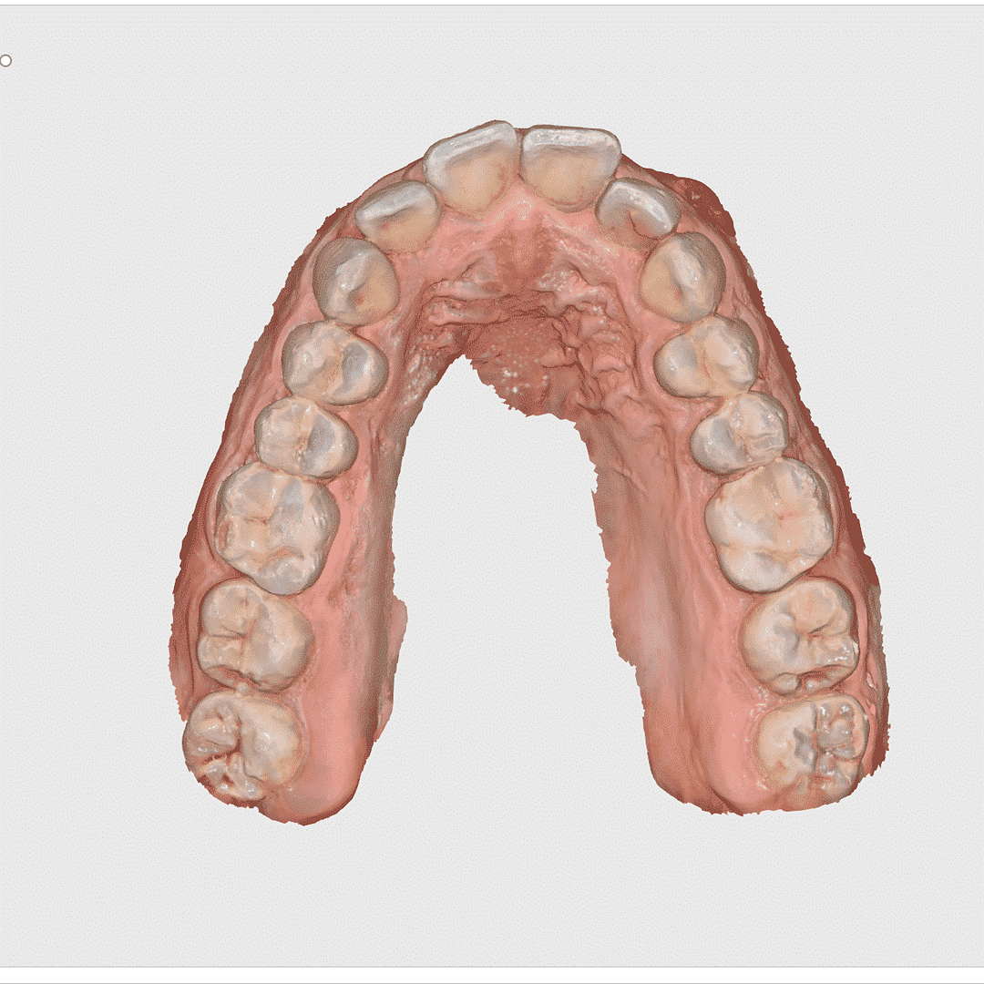 full-arch-scan-medit