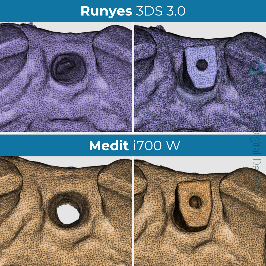idd-compares-medit-i700w-runyes-3ds-3.0-intraoral-scanner-scan-body-implant-stl-medit-design-tessellated-mesh-scans