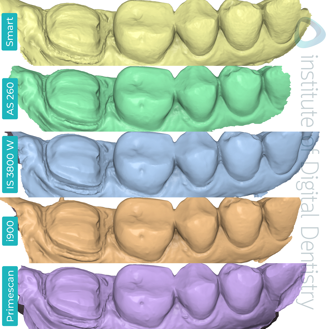 panda-smart-alliedstar-as260-dexis-is-3800-w-medit-i900-cerec-primescan-dentsply-sirona-idd-compares-institute-of-digital-dentistry-blog-medit-software-app-prep-margin-line-buccal-view