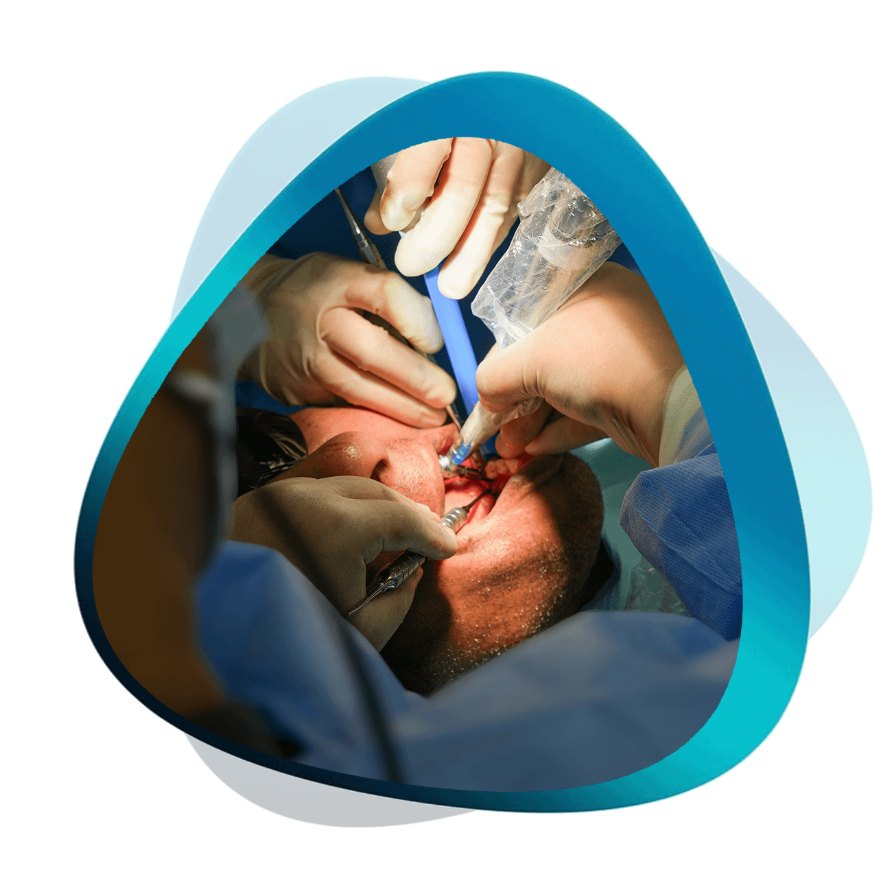 Learn Radiographic Interpretation | Institute Of Digital Dentistry