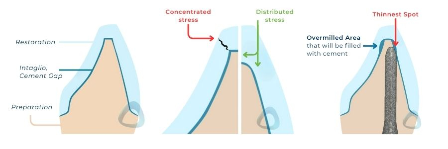 modern ceramic and milled ceramic restorations