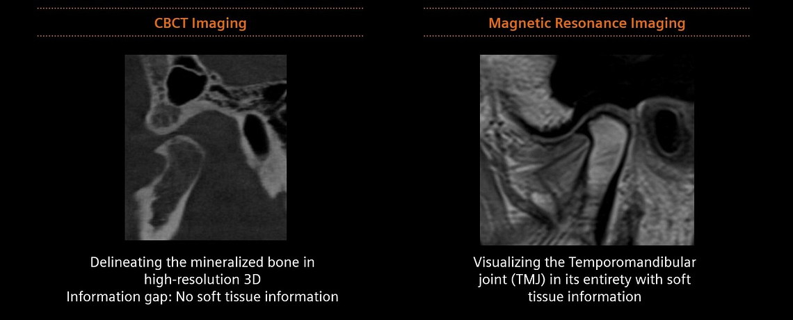 clinical-image-siemens-healthineers-dental-mri-Clinical-Evidence-tmj-idd-blog