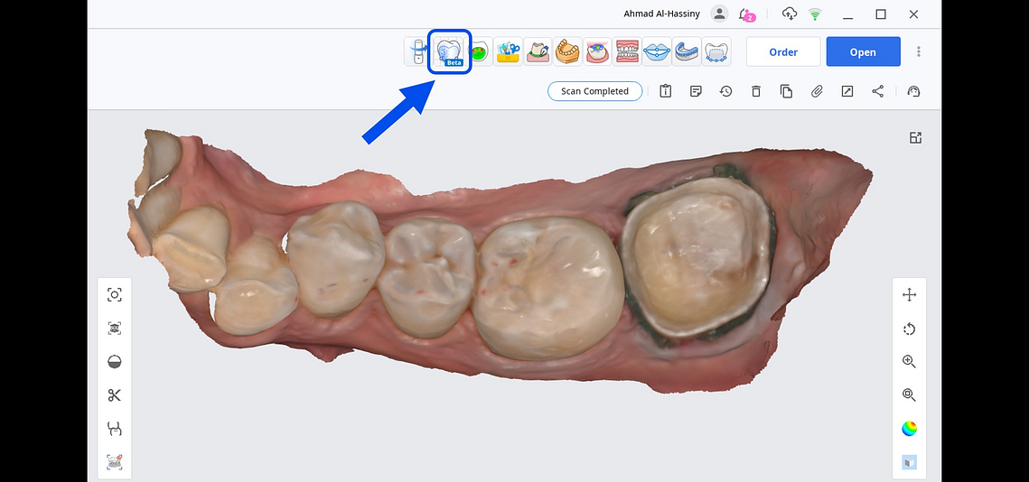 20 - Medit Innovation Day 2023 Presentation Single-Visit Restorations Using Medit ClinicCAD Ahmad Al-Hassiny - Slide20