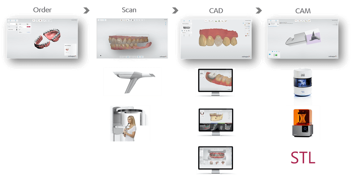 3shape-digital-workflow-idd-blog-institute-of-digital-dentistry-blog