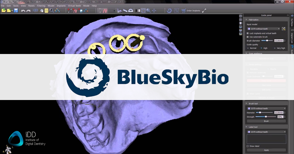 blue-sky-bio-dental-cad-software-idd