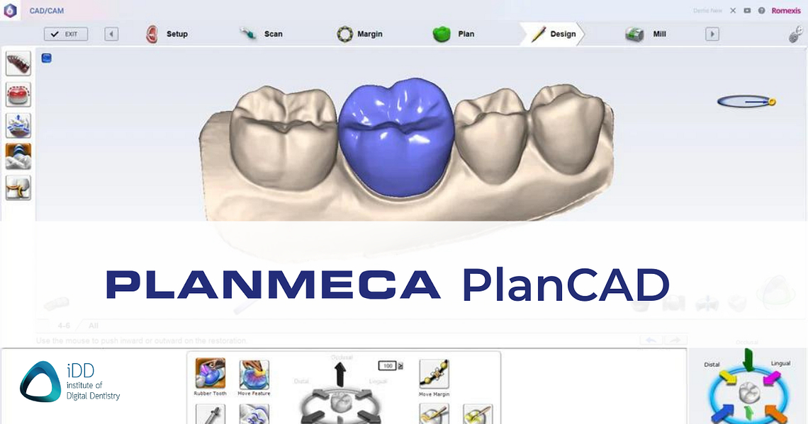 planmeca-plancad-easy-dental-cad-software-idd