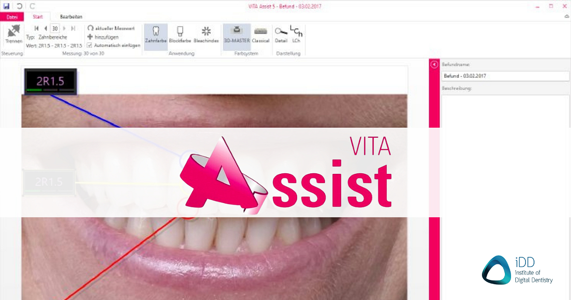 vita-assist-vita-zahnfabrik-dental-cad-software-shade-match-idd