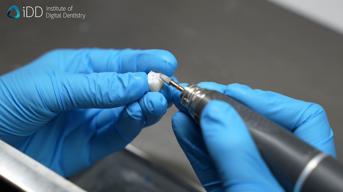 idd-3d-printing-dental-crowns-burr-post-processing-trimming