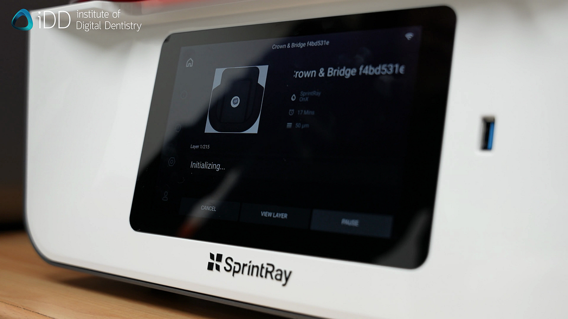 idd-3d-printing-dental-crowns-sprintray-pro-55s-system-3d-printer