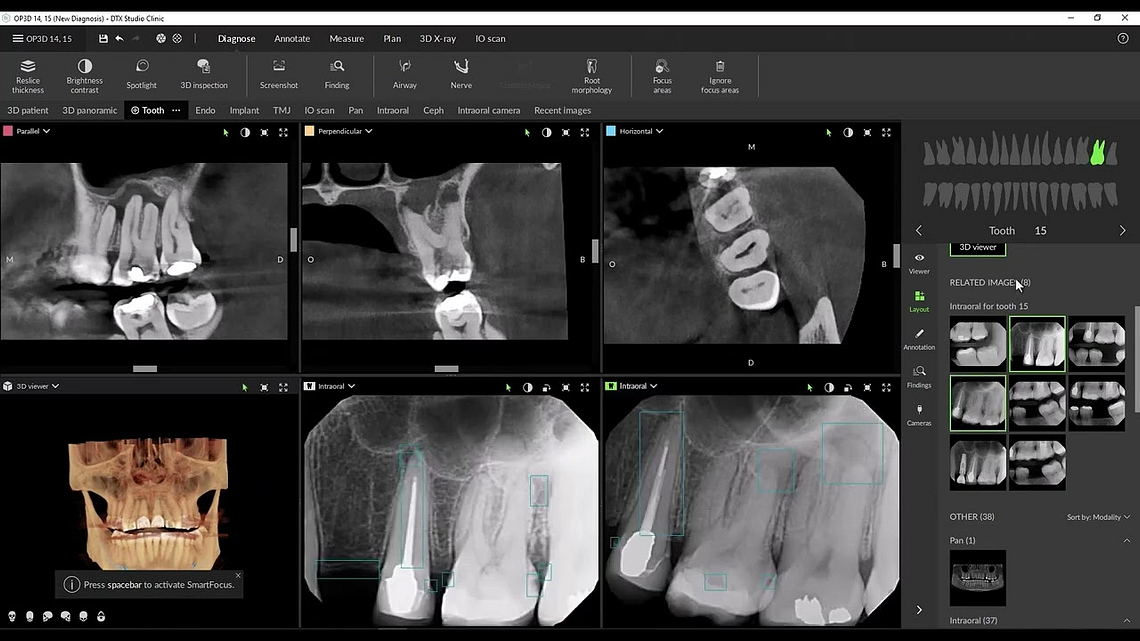 dexis-cbct-opg-idd-digital-dentistry-decoded-podcast-jordan-reiss