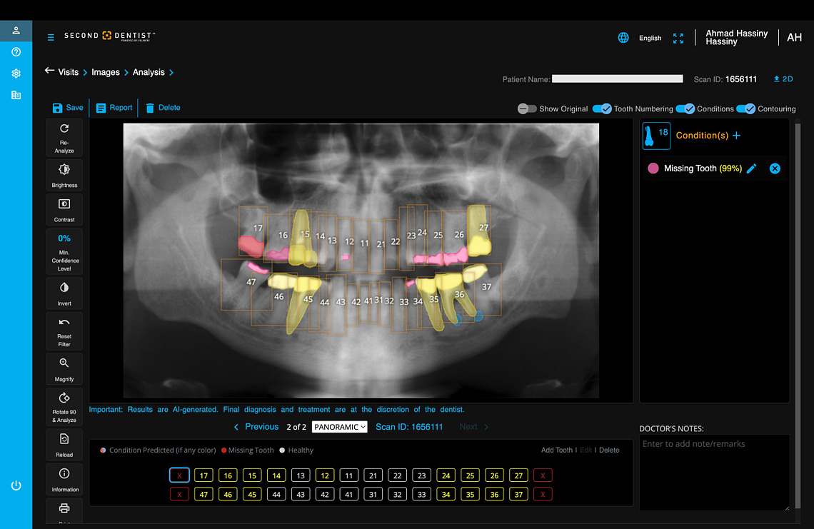 velmeni-second-dentist-ai-review-blog-idd-institute-of-digital-dentistry-software-image-analysis-panoramic-condition