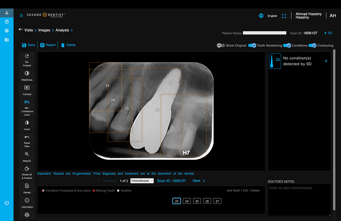 velmeni-second-dentist-ai-review-blog-idd-institute-of-digital-dentistry-software-patient-image-analysis-panoramic
