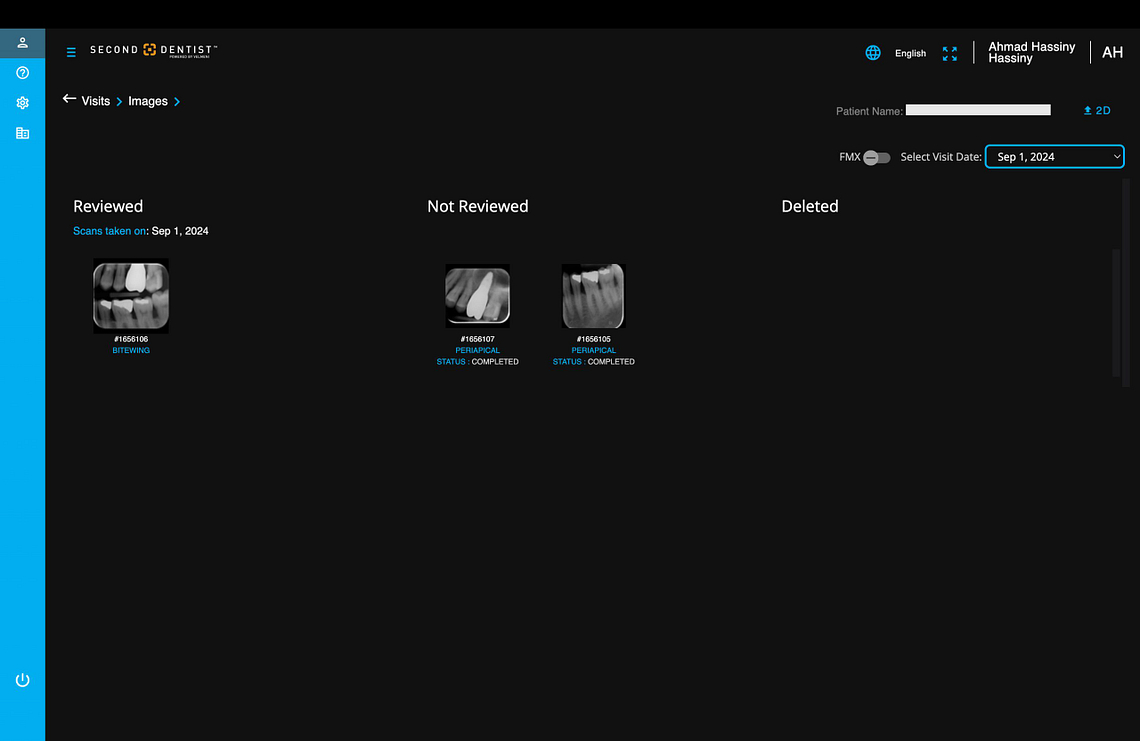 velmeni-second-dentist-ai-review-blog-idd-institute-of-digital-dentistry-software-patient-images