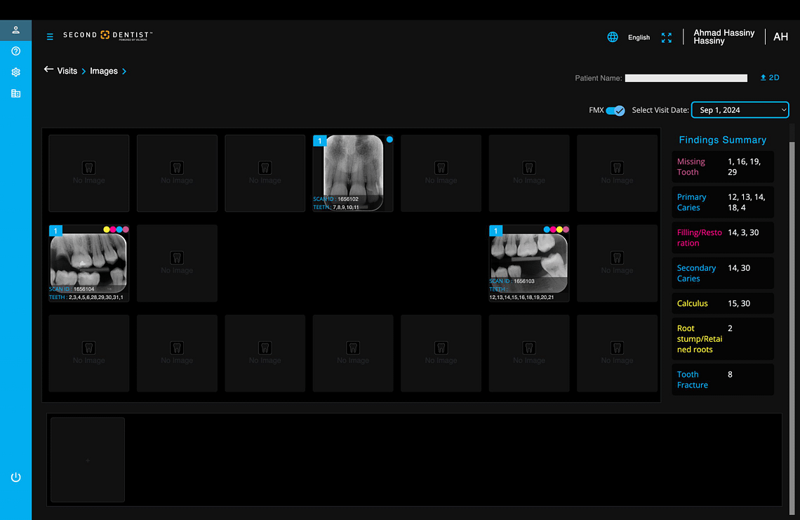 velmeni-second-dentist-ai-review-blog-idd-institute-of-digital-dentistry-software-patient-visit-images-findings-summary