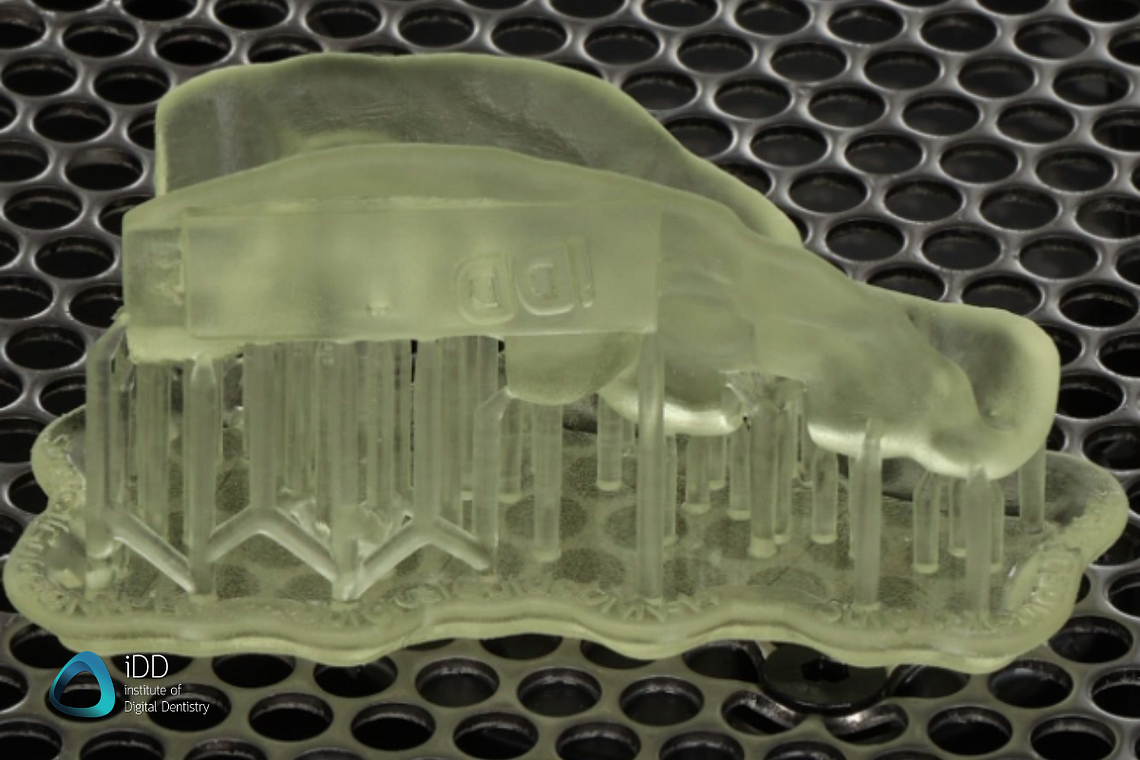 idd-3d-printed-surgical-guides-workflow-before-curing