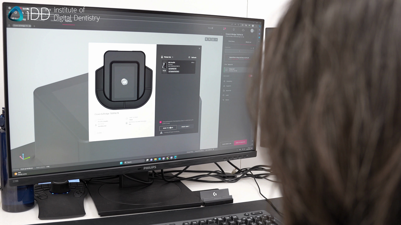How to 3D Print Dental Crowns with iDD - Institute of Digital Dentistry