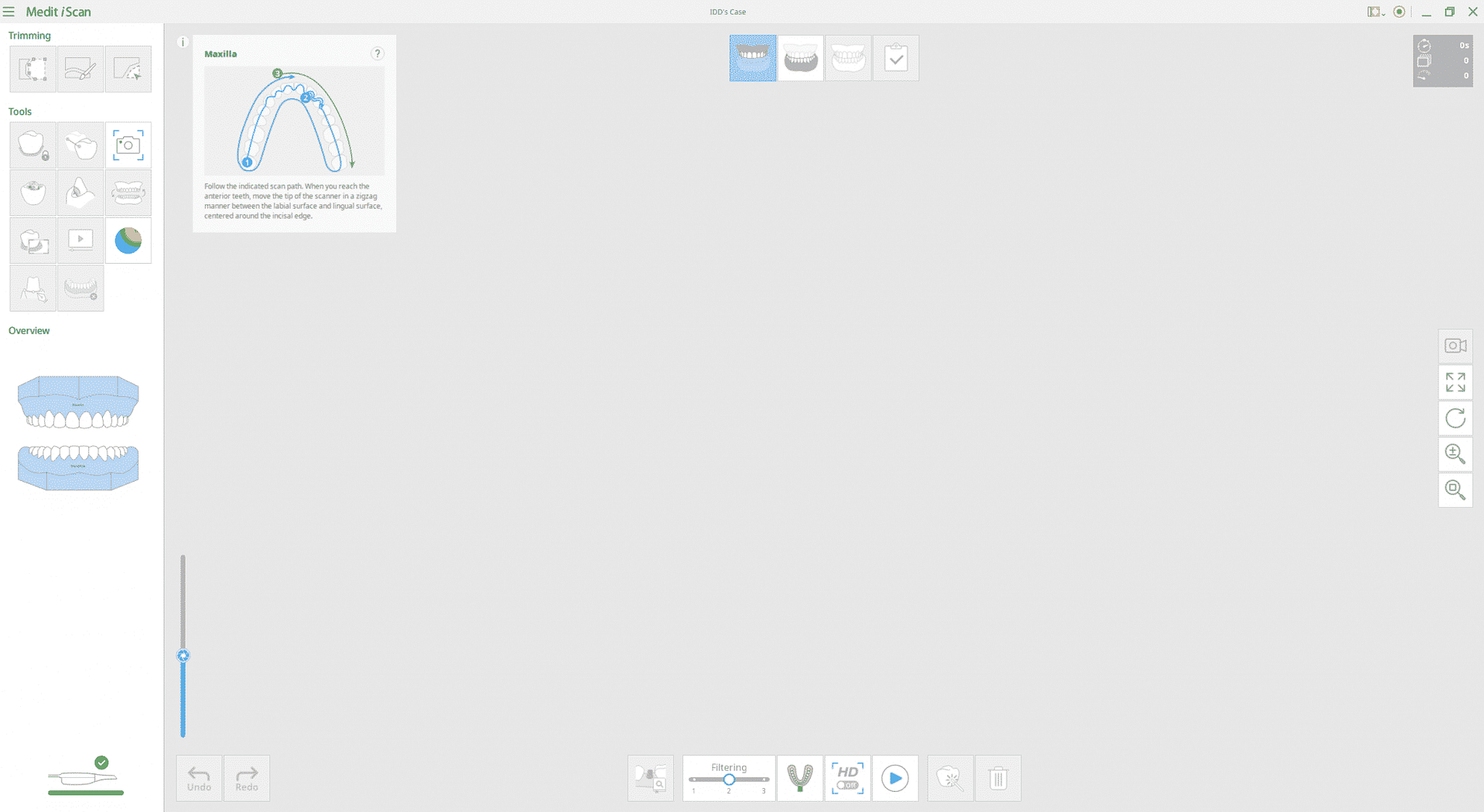 medit-link-software
