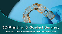 Formlabs-replay-3D-printing-and-guided-implant-surgery
