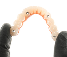 Full-arch implant restorations