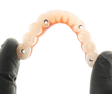 Full-arch implant restorations