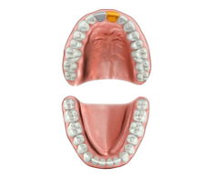 Digital smile design and treatment planning